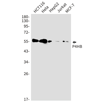 P4HB Rabbit Monoclonal Antibody | 兔单抗 | EnkiLife恩玑生命