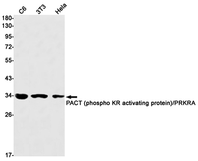 PRKRA Rabbit Monoclonal Antibody | 兔单抗 | EnkiLife恩玑生命