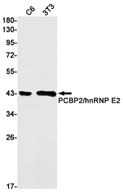 PCBP2 Rabbit Monoclonal Antibody | 兔单抗 | EnkiLife恩玑生命