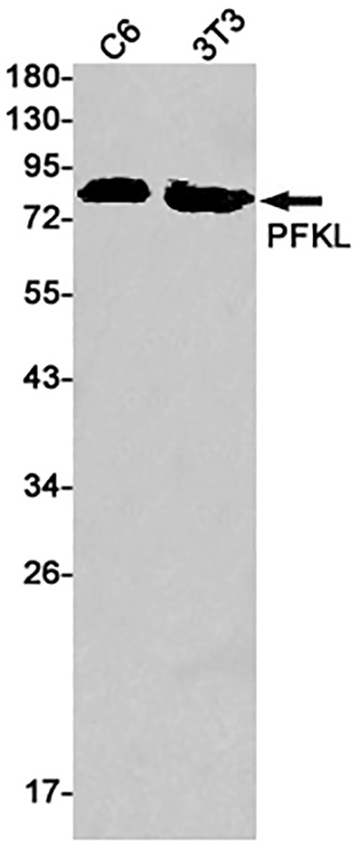 PFKL Rabbit Monoclonal Antibody | 兔单抗 | EnkiLife恩玑生命