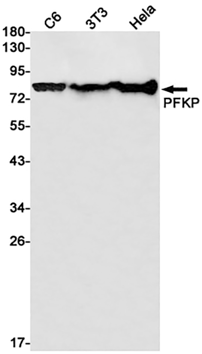 PFKP Rabbit Monoclonal Antibody | 兔单抗 | EnkiLife恩玑生命