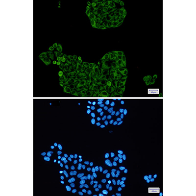 PFKP Rabbit Monoclonal Antibody | 兔单抗 | EnkiLife恩玑生命