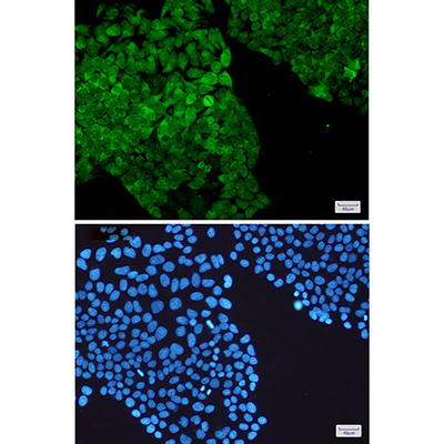 PGK1 Rabbit Monoclonal Antibody | 兔单抗 | EnkiLife恩玑生命
