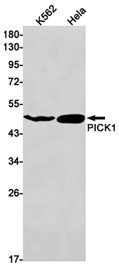 PICK1 Rabbit Monoclonal Antibody | 兔单抗 | EnkiLife恩玑生命