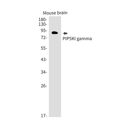 PIP5K1C Rabbit Monoclonal Antibody | 兔单抗 | EnkiLife恩玑生命