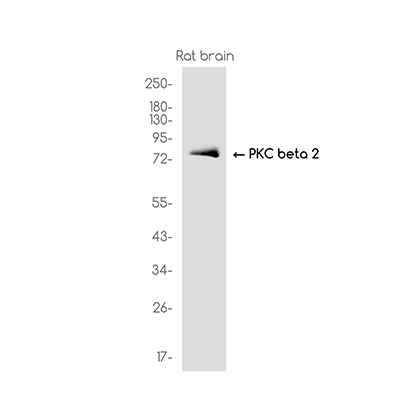 PKC beta 2 Rabbit Monoclonal Antibody | 兔单抗 | EnkiLife恩玑生命
