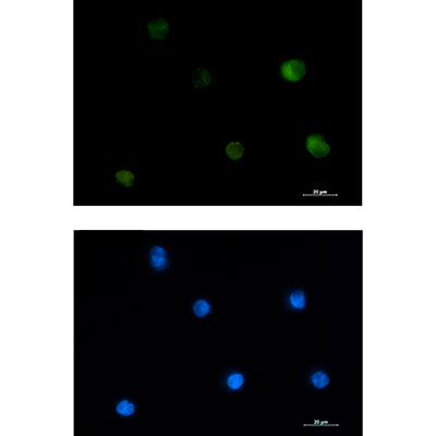 PKC beta 2 Rabbit Monoclonal Antibody | 兔单抗 | EnkiLife恩玑生命