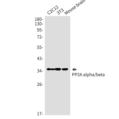 PP2A alpha/beta Rabbit Monoclonal Antibody | 兔单抗 | EnkiLife恩玑生命
