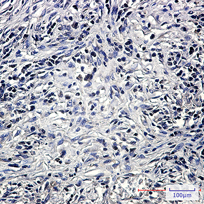 PP2A alpha/beta Rabbit Monoclonal Antibody | 兔单抗 | EnkiLife恩玑生命