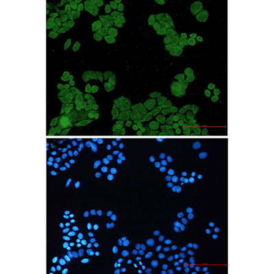 PP2A alpha/beta Rabbit Monoclonal Antibody | 兔单抗 | EnkiLife恩玑生命