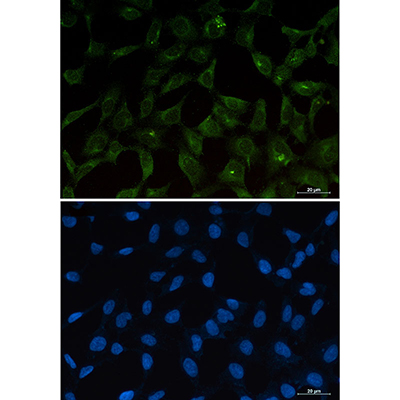 PUMA Rabbit Monoclonal Antibody | 兔单抗 | EnkiLife恩玑生命