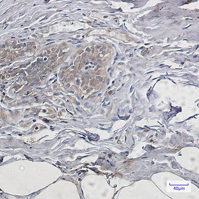 PUMA Rabbit Monoclonal Antibody | 兔单抗 | EnkiLife恩玑生命