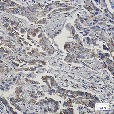 Rab7 Rabbit Monoclonal Antibody | 兔单抗 | EnkiLife恩玑生命