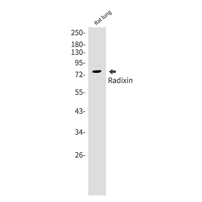 Radixin Rabbit Monoclonal Antibody | 兔单抗 | EnkiLife恩玑生命