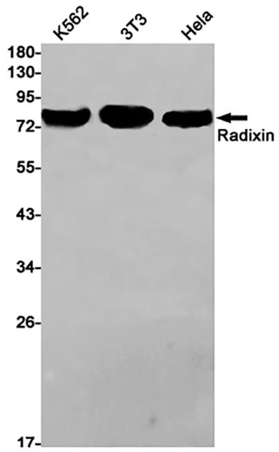 Radixin Rabbit Monoclonal Antibody | 兔单抗 | EnkiLife恩玑生命