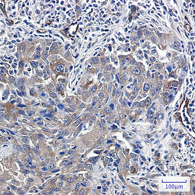 Radixin Rabbit Monoclonal Antibody | 兔单抗 | EnkiLife恩玑生命