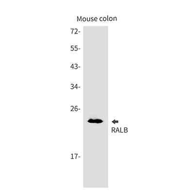 RALB Rabbit Monoclonal Antibody | 兔单抗 | EnkiLife恩玑生命