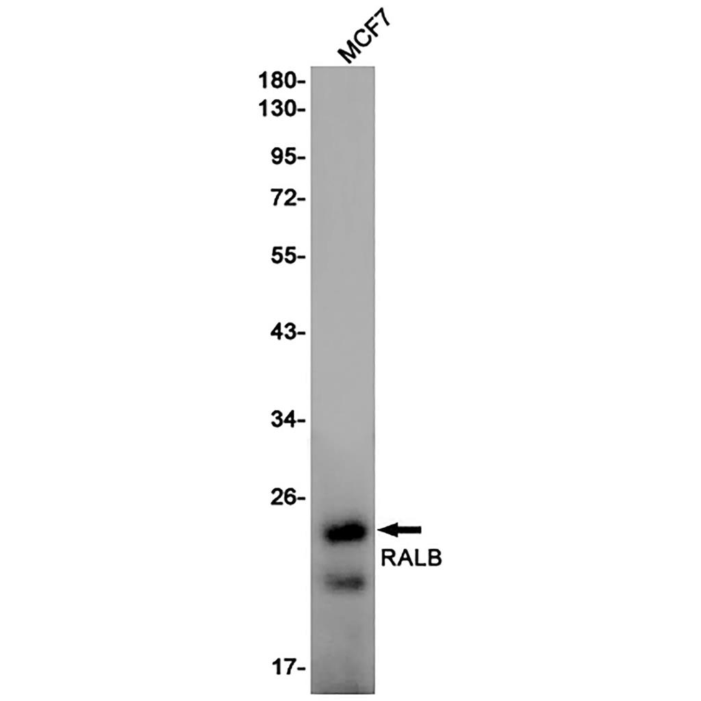 RALB Rabbit Monoclonal Antibody | 兔单抗 | EnkiLife恩玑生命