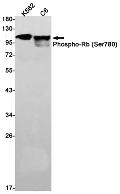 Phospho-Rb (Ser780) Rabbit Monoclonal Antibody | 兔单抗 | EnkiLife恩玑生命