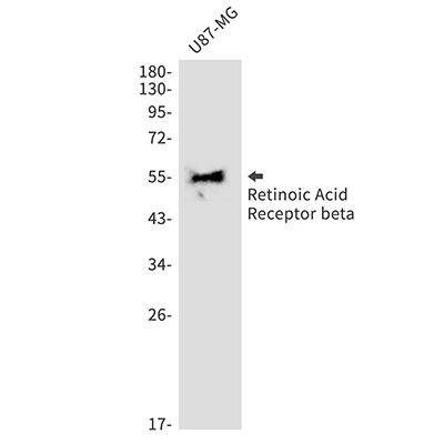 Retinoic Acid Receptor beta Rabbit Monoclonal Antibody | 兔单抗 | EnkiLife恩玑生命