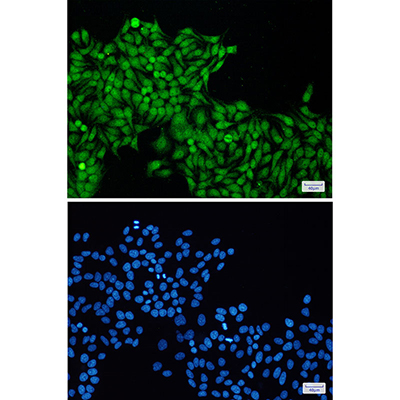 RBX1 Rabbit Monoclonal Antibody | 兔单抗 | EnkiLife恩玑生命