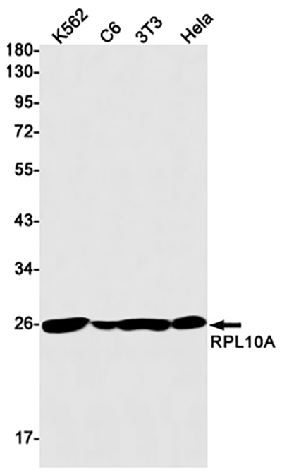 RPL10A Rabbit Monoclonal Antibody | 兔单抗 | EnkiLife恩玑生命
