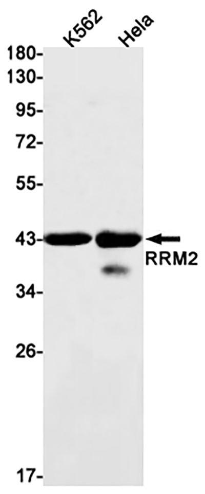 RRM2 Rabbit Monoclonal Antibody | 兔单抗 | EnkiLife恩玑生命