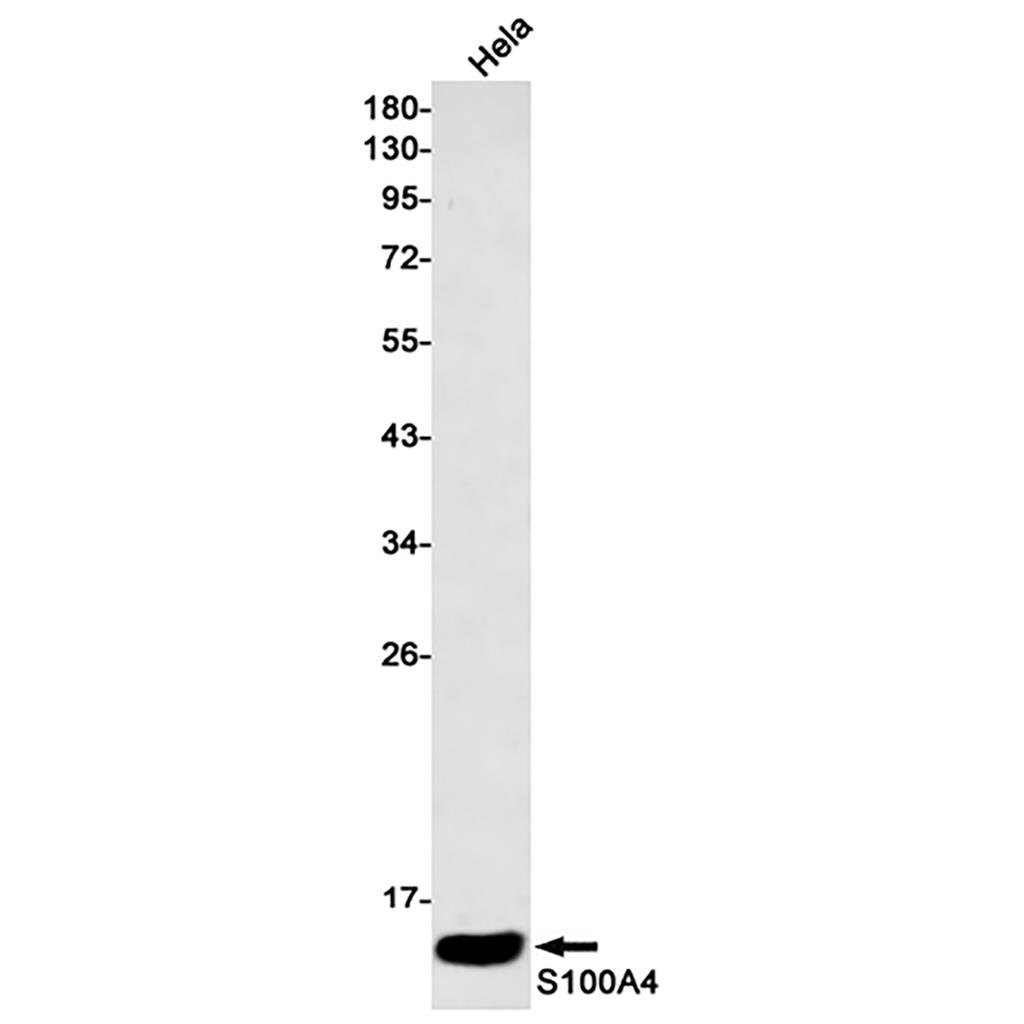 S100A4 Rabbit Monoclonal Antibody | 兔单抗 | EnkiLife恩玑生命