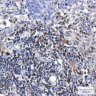 S100A4 Rabbit Monoclonal Antibody | 兔单抗 | EnkiLife恩玑生命