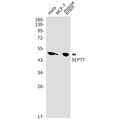 Septin 7 Rabbit Monoclonal Antibody | 兔单抗 | EnkiLife恩玑生命
