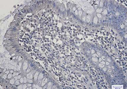 SIRT2 Rabbit Monoclonal Antibody | 兔单抗 | EnkiLife恩玑生命