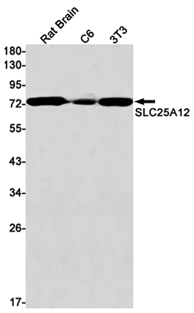 SLC25A12 Rabbit Monoclonal Antibody | 兔单抗 | EnkiLife恩玑生命