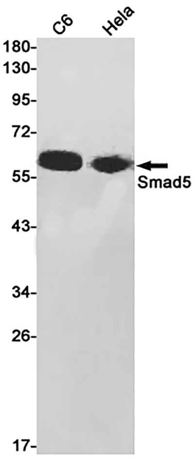 Smad5 Rabbit Monoclonal Antibody | 兔单抗 | EnkiLife恩玑生命