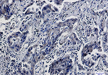 Smad5 Rabbit Monoclonal Antibody | 兔单抗 | EnkiLife恩玑生命