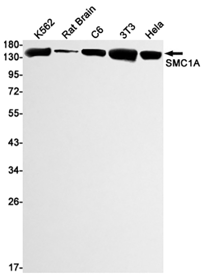 SMC1A Rabbit Monoclonal Antibody | 兔单抗 | EnkiLife恩玑生命