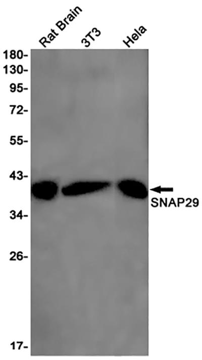 SNAP29 Rabbit Monoclonal Antibody | 兔单抗 | EnkiLife恩玑生命