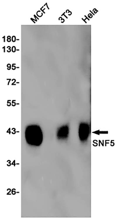 SMARCB1 Rabbit Monoclonal Antibody | 兔单抗 | EnkiLife恩玑生命