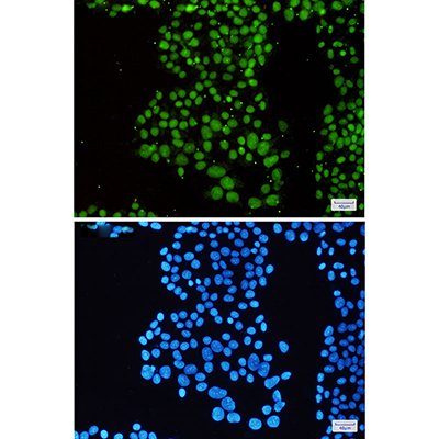 SMARCB1 Rabbit Monoclonal Antibody | 兔单抗 | EnkiLife恩玑生命
