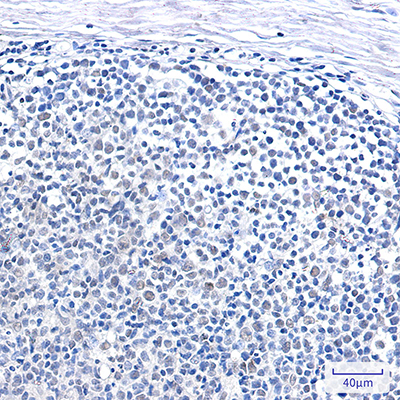 SMARCB1 Rabbit Monoclonal Antibody | 兔单抗 | EnkiLife恩玑生命