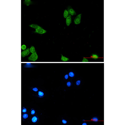Survivin Rabbit Monoclonal Antibody | 兔单抗 | EnkiLife恩玑生命
