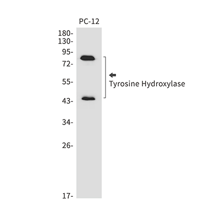 Tyrosine Hydroxylase Rabbit Monoclonal Antibody | 兔单抗 | EnkiLife恩玑生命