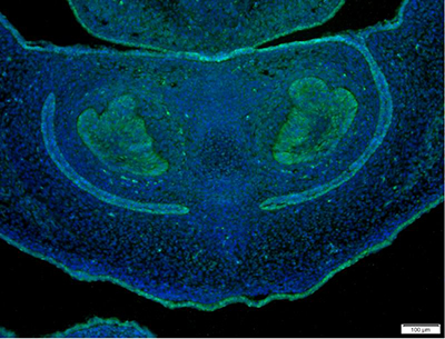 YAP1 Rabbit Monoclonal Antibody | 兔单抗 | EnkiLife恩玑生命