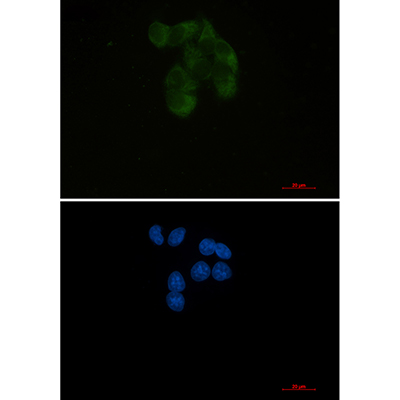 YB1 Rabbit Monoclonal Antibody | 兔单抗 | EnkiLife恩玑生命