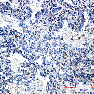 YB1 Rabbit Monoclonal Antibody | 兔单抗 | EnkiLife恩玑生命