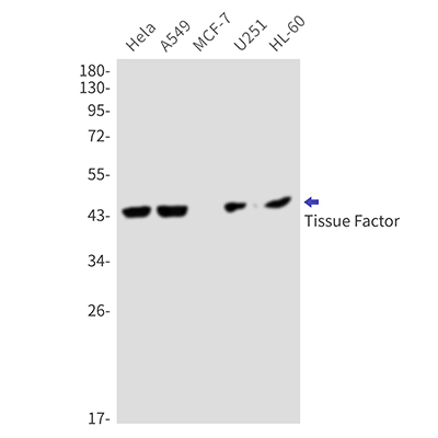 Tissue Factor Rabbit Monoclonal Antibody | 兔单抗 | EnkiLife恩玑生命