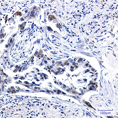 Tissue Factor Rabbit Monoclonal Antibody | 兔单抗 | EnkiLife恩玑生命
