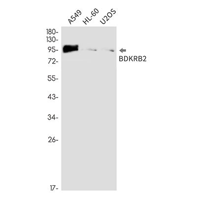 BDKRB2 Rabbit Monoclonal Antibody | 兔单抗 | EnkiLife恩玑生命
