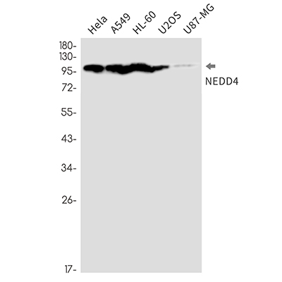 NEDD4 Rabbit Monoclonal Antibody | 兔单抗 | EnkiLife恩玑生命