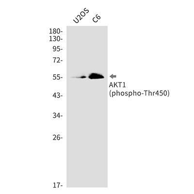 Phospho-AKT1 (Thr450) Rabbit Monoclonal Antibody | 兔单抗 | EnkiLife恩玑生命