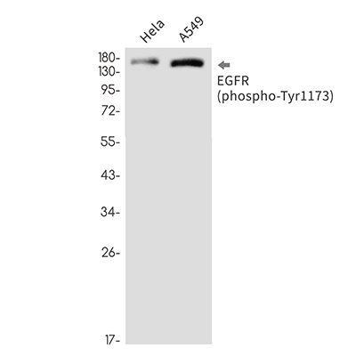 Phospho-EGFR (Tyr1173) Rabbit Monoclonal Antibody | 兔单抗 | EnkiLife恩玑生命